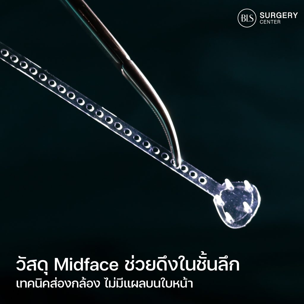 อายุเท่าไหร่ควรดึงหน้า ส่องกล้องดึงหน้าดีไหม