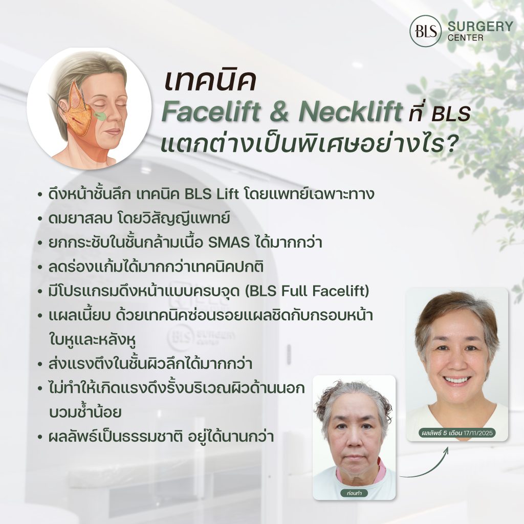 ศัลยกรรมใบหน้า พักฟื้นกี่วัน ศัลยกรรมดึงหน้าอยู่ได้กี่ปี? 